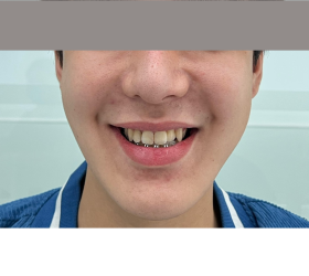 RĂNG SỨ THẨM MỸ