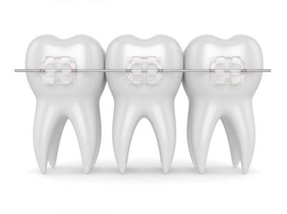 MẮC C&Agrave;I SỨ 