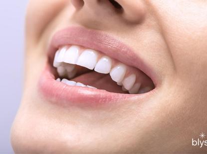 Tẩy trắng răng bằng đ&egrave;n Plasma