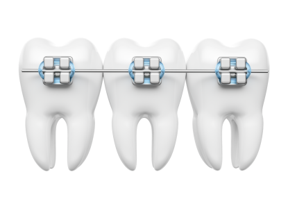 MẮC C&Agrave;I KIM LOẠI 